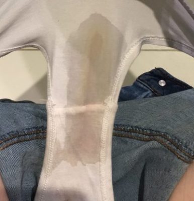 Watery Vaginal Discharge